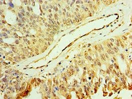 Polyclonal Rabbit anti-Human MAP2K3 / MEK3 / MKK3 Antibody (aa1-170, IHC)