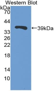 TFF3 / Trefoil Factor 3 Antibody (aa22-80)