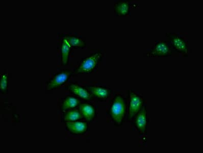 ZMYND11 / BS69 Antibody