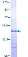 Human IL12B / IL12 p40 Protein (Recombinant GST, N-terminus)
