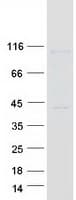 Human GRIN1 / NMDAR1 Protein (Recombinant Myc-DDK (Flag))
