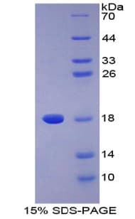 Human PLA2G2A / SPLA2 Protein (Recombinant His, N-Terminal)