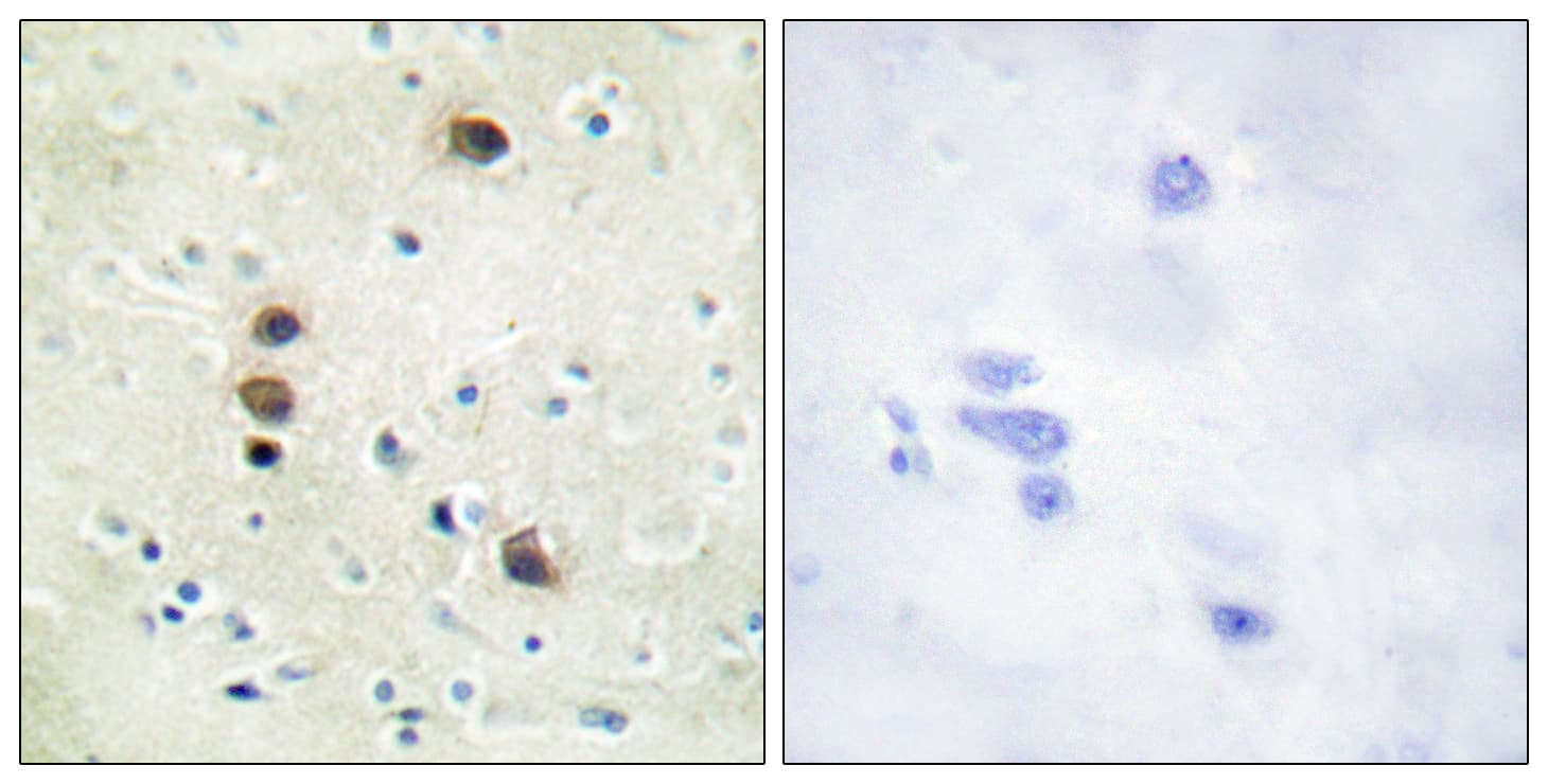 Polyclonal Rabbit anti-Human PRKD1 / PKC Mu Antibody (phospho-Ser205, IHC, WB)
