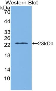WARS Antibody (aa29-195)