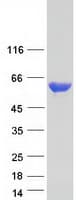 Human PKM / Pyruvate Kinase, Muscle Protein (Recombinant Myc-DDK (Flag))