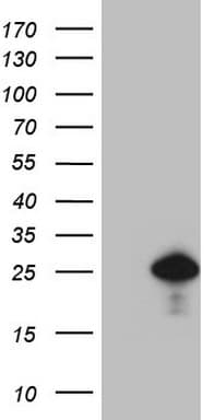 CDKN1A / WAF1 / p21 Antibody (aa2-164, clone OTI4B11)