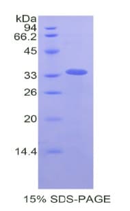 Human LOXL4 / LOXC Protein (Recombinant His,N-terminus)