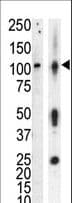 Polyclonal Rabbit anti-Human PKD3 / PRKD3 Antibody (aa352-384, IHC, IF, WB)