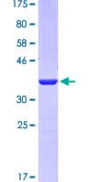 Human MB / Myoglobin Protein (Recombinant GST, N-terminus)
