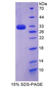 Mouse CYP27B1 Protein (Recombinant His-T7)