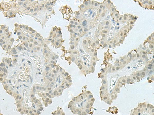 MECOM / EVI1 Antibody