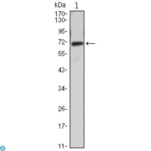 FAK / Focal Adhesion Kinase Antibody