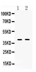 ISLET-1 / ISL1 Antibody