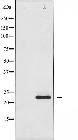 Polyclonal Rabbit anti-Human SOCS2 Antibody (IF, WB)