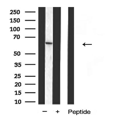 DCT / Dopachrome Tautomerase Antibody