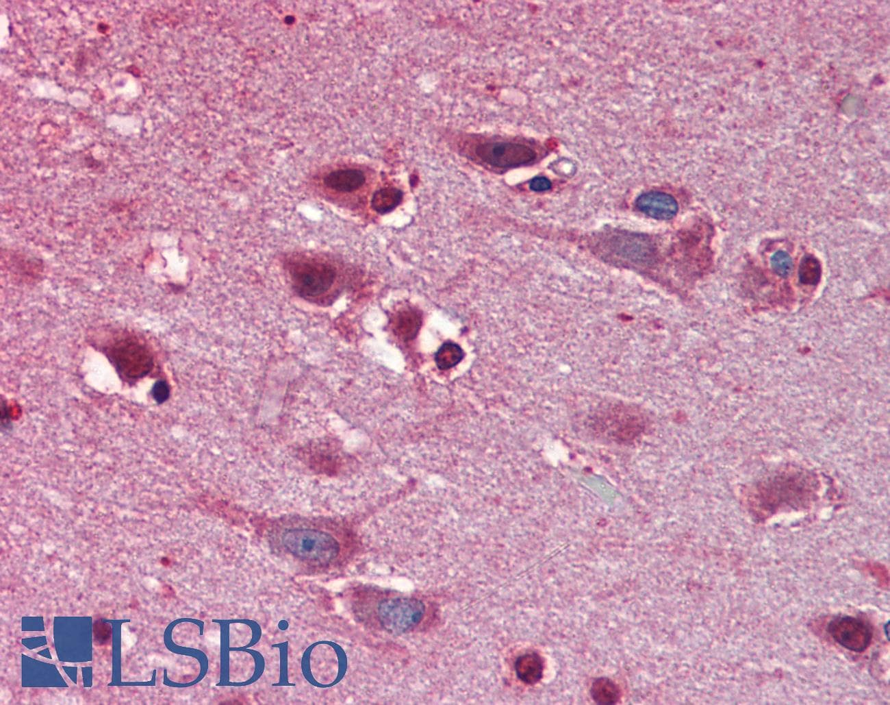 IHC-plus™ Polyclonal Rabbit anti-Human SPRED1 Antibody (IHC, IF, WB)