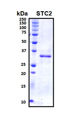 Human STC2 / Stanniocalcin 2 Protein (Recombinant His, N-Terminal)