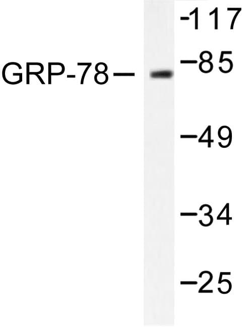 HSPA5 / GRP78 / BiP Antibody (Pro641)