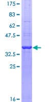 Human GAPDH Protein (Recombinant GST, N-terminus)