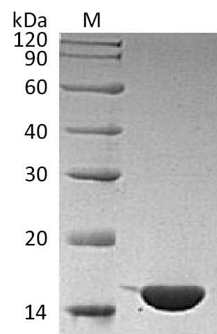 Human IL1F9 Protein (Recombinant)