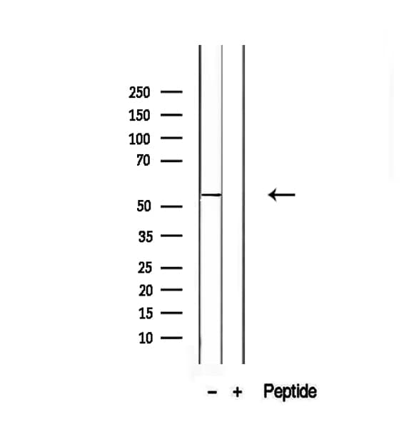 SLC13A2 / NaCT Antibody