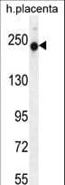 RUSC2 Antibody (aa308-336)