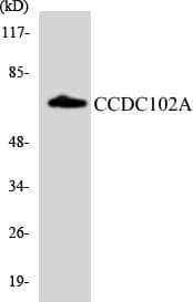 CCDC102A Antibody (aa333-382)