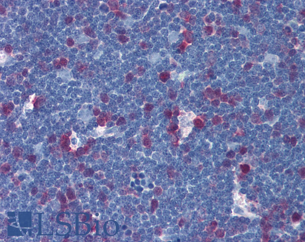 IHC-plus™ TS / Thymidylate Synthase Antibody (clone 2B2)