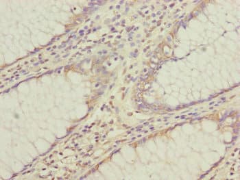 CEP95 / CCDC45 Antibody
