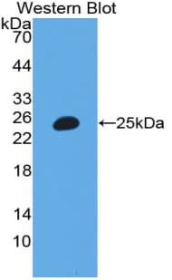 ITIH3 Antibody (aa279-467)