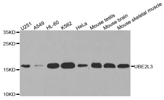 Polyclonal Rabbit anti-Human UBE2L3 / UBCH7 Antibody (IHC, WB)