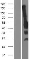 Human CDKN1C / p57 Kip2 Protein (Over-Expression Lysate Myc-DDK (Flag))