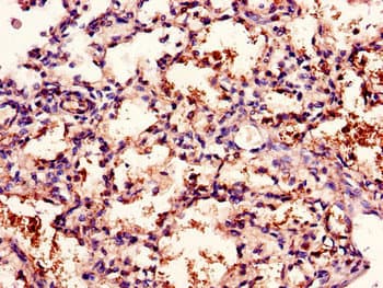 Polyclonal Rabbit anti-Human CD96 / TACTILE Antibody (IHC, IF)