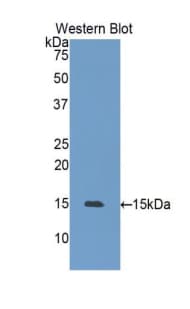 HSPH1 / HSP105 Antibody (aa388-505, FITC)