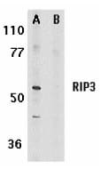 RIPK3 / RIP3 Antibody