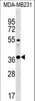 Polyclonal Rabbit anti-Human CTRB1 / Chymotrypsinogen B1 Antibody (aa145-171, WB)