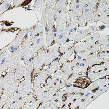 MMP9 / Gelatinase B Antibody
