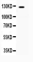 AF5Q31 / AFF4 Antibody