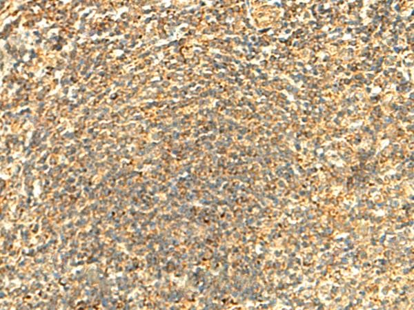 Polyclonal Rabbit anti-Human ABHD10 Antibody (IHC)