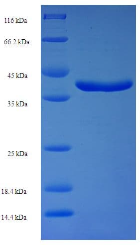 Human RAB11A Protein (Recombinant His-SUMO)