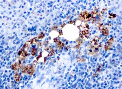 Recombinant Monoclonal Mouse anti-Human ACP5 / TRAP Antibody (clone rACP5/1070, IHC)