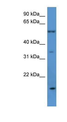 Polyclonal Rabbit anti-Human OR2J2 Antibody (C-Terminus, WB)