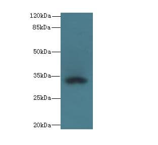 CCDC24 Antibody (Coiled-coil domain)