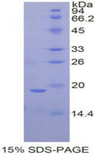 Rat POSTN / Periostin Protein (Recombinant His)