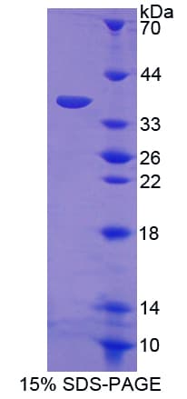 Mouse RELA / NFKB p65 Protein (Recombinant His, N-Terminal)