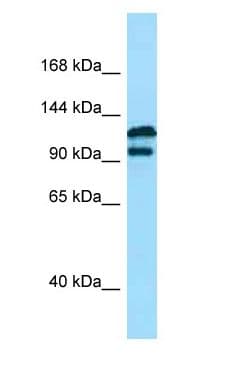 Polyclonal Rabbit anti-Human DPP9 Antibody (aa87-136, WB)