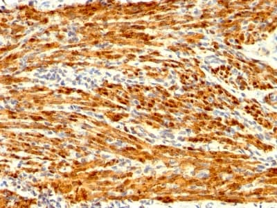 Recombinant Monoclonal Rabbit anti-Human CNN1 / Calponin Antibody (clone CNN1/1408R, Azide-free,Carrier-free, IHC, IF)