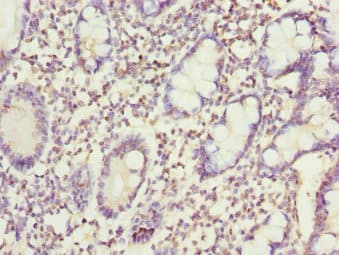 SNX7 Antibody