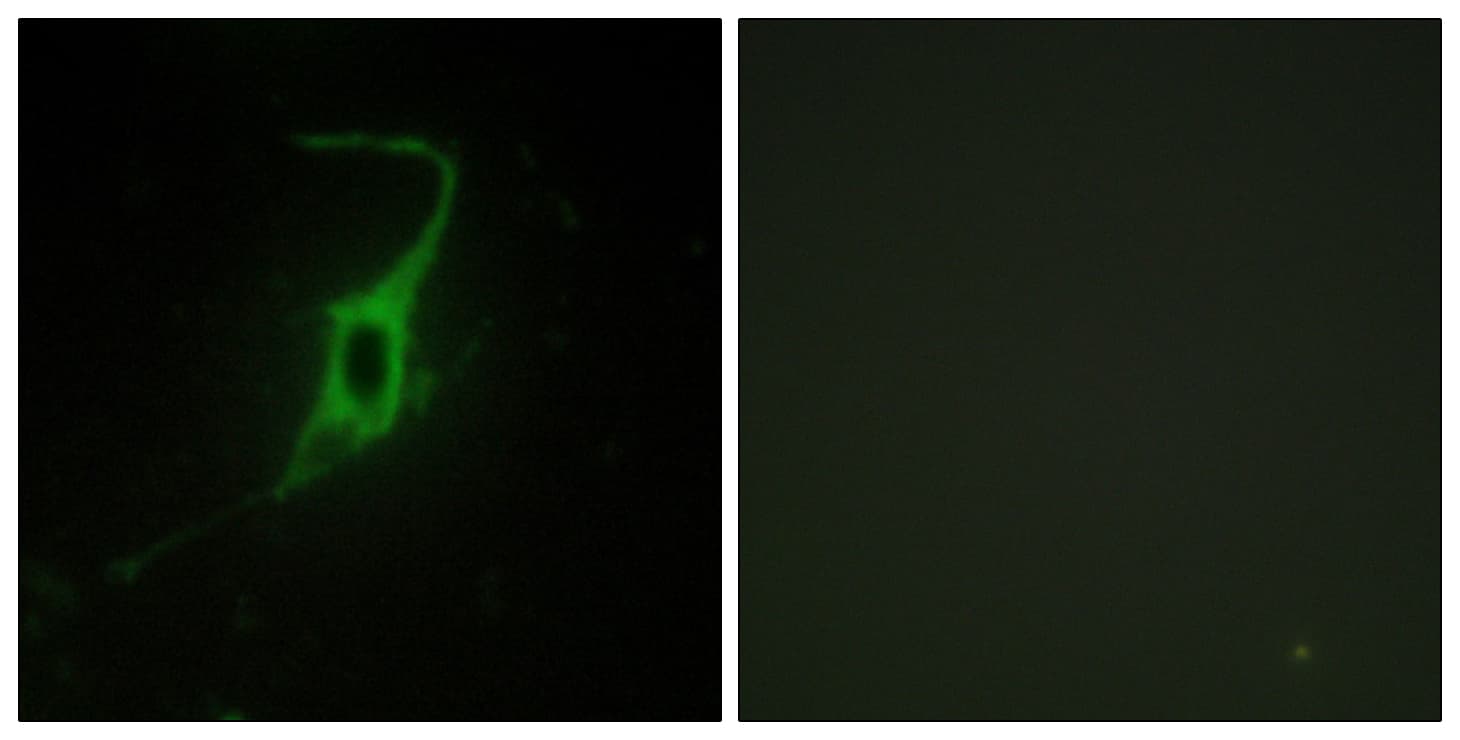 CDH20 / Cadherin 20 Antibody (aa111-160)