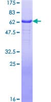 Human APP / Beta Amyloid Precursor Protein (Recombinant GST)